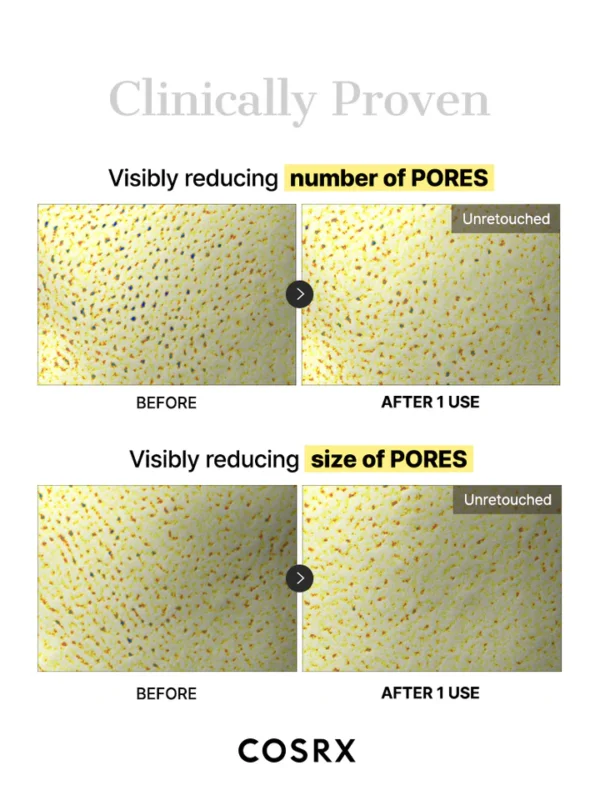 ماسک هیدروژلی حلزون کوزارکس 4