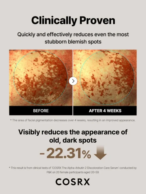 The_Alpha-arbutin_2_Serum_11_720x سرم آلفا آربوتین 2 درصد کوزارکس تصویر پوست