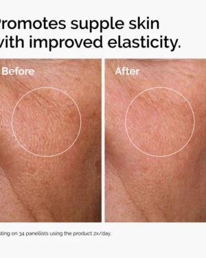 سرم هیالورونیک اسید اوردینری 2