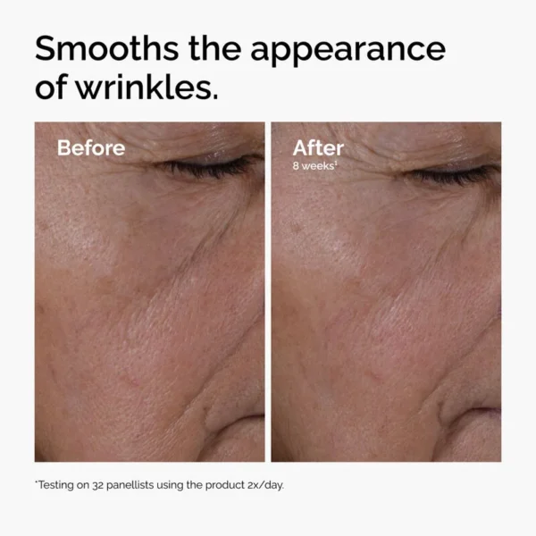 ord-multi-peptide-ha-serum-wrinkles-before-after سرم ضد چروک مولتی پپتاید اوردینری تست