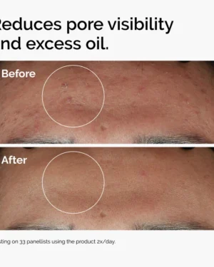 سرم نیاسینامید و زینک اوردینری