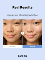 تاثیر سرم آبرسان هیالورونیک اسید 3