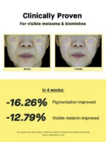 تست سرم ویتامین سی 23 درصد کوزارکس