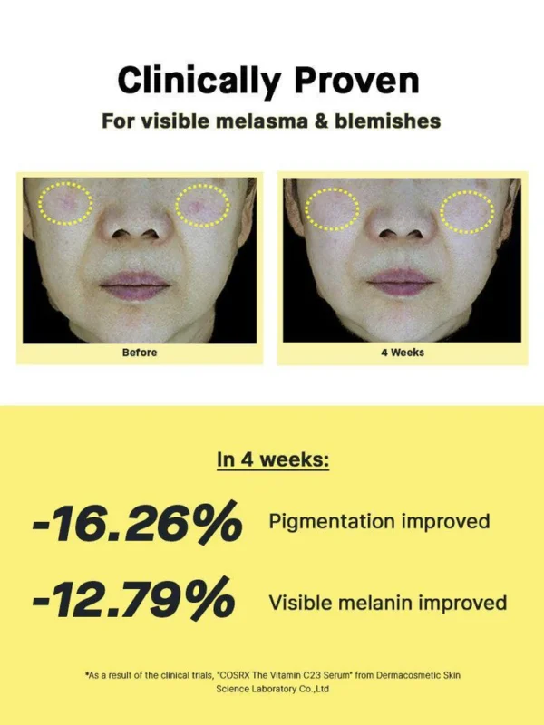 تست سرم ویتامین سی 23 درصد کوزارکس